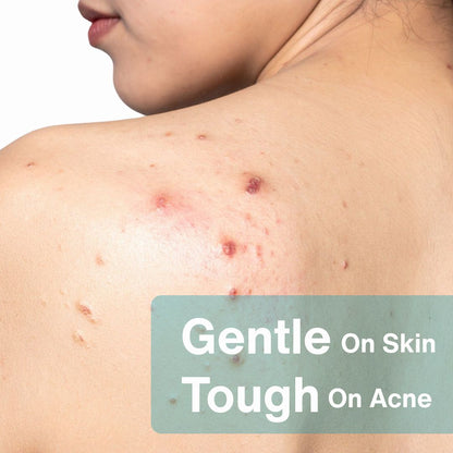 Anti-Acne AHA/BHA Body Wash