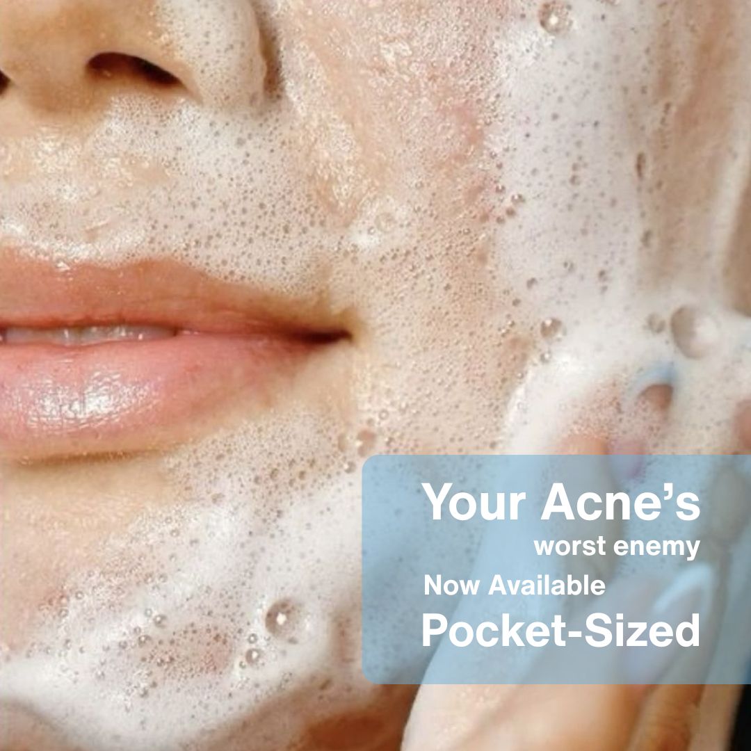 Anti Acne Cleanser 50ml